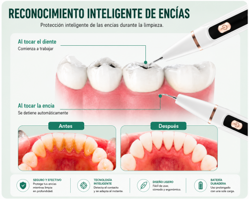 Reconocimiento inteligente de encías