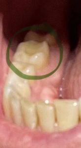 Cepillo Dental Ultrasonico Garaldentist photo review