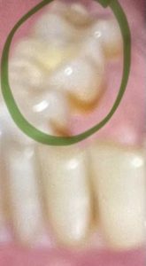 Cepillo Dental Ultrasonico Garaldentist photo review